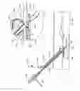 Fig. 65 - Interventional medical closure device
