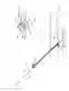 Fig. 71 - Interventional medical closure device