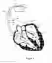 Fig. 06 - Post-shock management of implantable cardiac device features