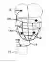 Fig. 01 - Multi-site pacemaker with slaved eletrodes network