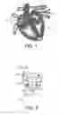 Fig. 02 - Multi-site pacemaker with slaved eletrodes network