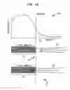 Fig. 06 - Simultaneous delivery of electrical and acoustical stimulation in a hearing prosthesis