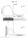 Fig. 09 - Simultaneous delivery of electrical and acoustical stimulation in a hearing prosthesis