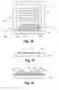 Fig. 07 - Method and apparatus for delivering an implantable wireless sensor for in vivo pressure measurement