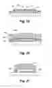 Fig. 08 - Method and apparatus for delivering an implantable wireless sensor for in vivo pressure measurement