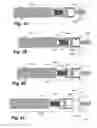Fig. 14 - Method and apparatus for delivering an implantable wireless sensor for in vivo pressure measurement