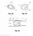 Fig. 16 - Method and apparatus for delivering an implantable wireless sensor for in vivo pressure measurement