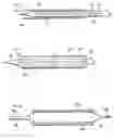 Fig. 03 - SMALL VESSEL EXPANDABLE STENT AND METHOD FOR PRODUCTION OF SAME
