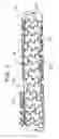 Fig. 03 - Bifurcation stent assembly