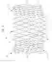 Fig. 05 - Bifurcation stent assembly