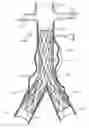 Fig. 01 - Self expanding bifurcated endovascular prosthesis