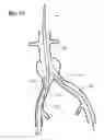 Fig. 09 - Self expanding bifurcated endovascular prosthesis