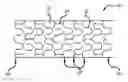 Fig. 01 - Method of manufacturing an implantable polymeric medical device