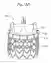 Fig. 16 - Rapid deployment prosthetic heart valve