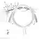 Fig. 04 - Extraocular muscle prosthesis