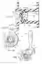 Fig. 03 - Voice Prosthesis Device