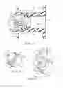 Fig. 04 - Voice Prosthesis Device