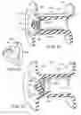 Fig. 07 - Voice Prosthesis Device