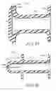 Fig. 10 - Voice Prosthesis Device