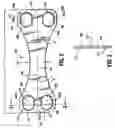 Fig. 03 - Method of repairing a bone joint