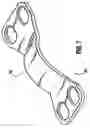 Fig. 06 - Method of repairing a bone joint