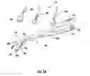 Fig. 03 - System and method for implanting intervertebral disk prostheses