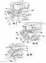 Fig. 04 - System and method for implanting intervertebral disk prostheses
