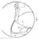 Fig. 05 - Mechanical apparatus and method for artificial disc replacement