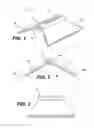 Fig. 02 - Spinal disc annulus reconstruction method and deformable spinal disc annulus stent