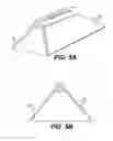 Fig. 04 - Spinal disc annulus reconstruction method and deformable spinal disc annulus stent