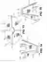 Fig. 11 - Spinal disc annulus reconstruction method and deformable spinal disc annulus stent
