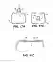 Fig. 13 - Spinal disc annulus reconstruction method and deformable spinal disc annulus stent