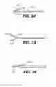 Fig. 17 - Spinal disc annulus reconstruction method and deformable spinal disc annulus stent