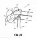 Fig. 27 - Spinal disc annulus reconstruction method and deformable spinal disc annulus stent