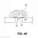 Fig. 29 - Spinal disc annulus reconstruction method and deformable spinal disc annulus stent