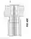 Fig. 41 - Spinal disc annulus reconstruction method and deformable spinal disc annulus stent