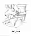 Fig. 46 - Spinal disc annulus reconstruction method and deformable spinal disc annulus stent