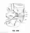 Fig. 47 - Spinal disc annulus reconstruction method and deformable spinal disc annulus stent