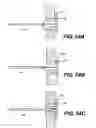 Fig. 57 - Spinal disc annulus reconstruction method and deformable spinal disc annulus stent