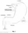 Fig. 02 - Positioning tools and methods for implanting medical devices