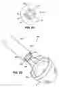 Fig. 09 - Positioning tools and methods for implanting medical devices