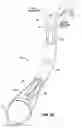 Fig. 10 - Positioning tools and methods for implanting medical devices