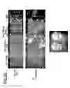 Fig. 12 - Marker for undifferentiated state of cell and composition and method for separation and preparation of stem cells