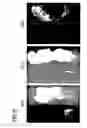 Fig. 14 - Marker for undifferentiated state of cell and composition and method for separation and preparation of stem cells