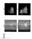 Fig. 17 - Marker for undifferentiated state of cell and composition and method for separation and preparation of stem cells