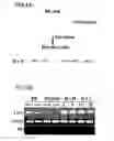 Fig. 25 - Marker for undifferentiated state of cell and composition and method for separation and preparation of stem cells