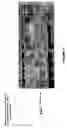 Fig. 12 - Identification of a JAK2 mutation involved in Vaquez Polyglobulia