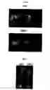 Fig. 06 - CD9/CD81 double-deficient non-human animal