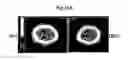 Fig. 09 - CD9/CD81 double-deficient non-human animal