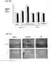 Fig. 04 - SCREENING SYSTEMS AND METHODS FOR IDENTIFYING MODULATORS OF XENOBIOTICMETABOLISM